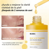 Sérum Intensivo Cúrcuma + Ácido Kójico — Lumíne